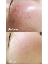 ココ 2号店(CoCo)/