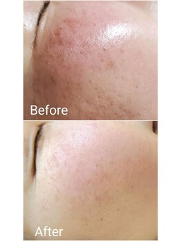 ココ 2号店(CoCo)/