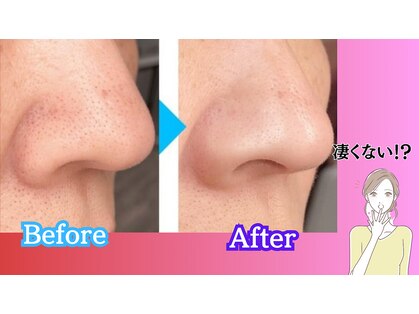 ヴィヴィアンの写真