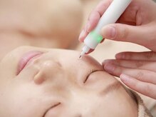 カラット ベル店(KARAT)/シミケアトリートメント