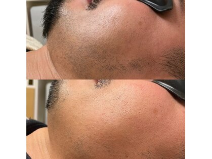 シャルム(Charme)の写真