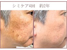 ビィーチェ(VIECE)の雰囲気(男女関係なし!シミケア目元・口元も施術可能!)