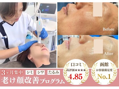 グラチア(Gratiae)の写真