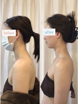 ドマーニ(Domani)/奇跡の10分！頚椎リヴァイブ