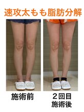 鍼灸サロンオランジュ 高槻富田院/