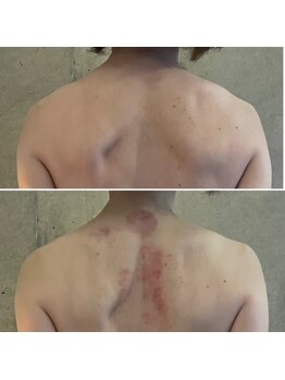 サプナジー(Suppnrgy)/カスタムトリートメント