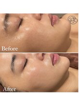 ミエル 神戸店(Miel)/リアボーテタラソトリートメント