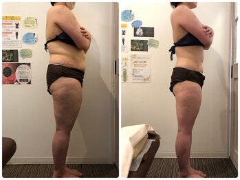 鈴木整体院 仙台泉院/小顔造顔/骨盤矯正/痩身整体