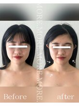 モア 吉祥寺(MORE.)/BeforeAfter