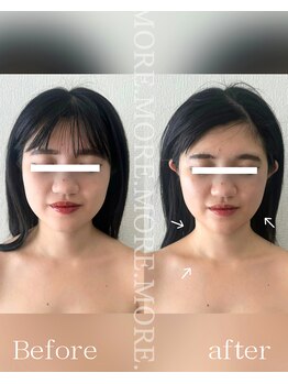 モア 吉祥寺(MORE.)/BeforeAfter