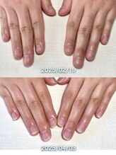 ポメロ(POMELO)/短期集中のケアで爪の形は変わる