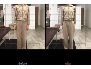 ストレチックス 近江八幡店/BeforeAfter