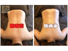 イチマルロク(106)/圧倒的な効果に自信があります☆