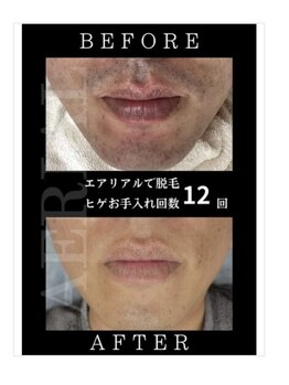 エアリアル 八代店/写真を見て本人もビックリ！