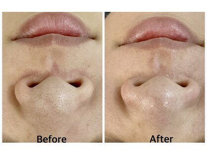 アンベリール(Embellir)の写真