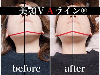 バリンタイ(Bali'n Thai)