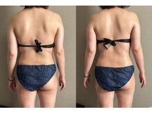 ミシェル(Michell)/結果重視の痩身ケア