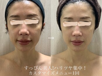 バービーフェイス 恵比寿(Barbie Face)/ハリ艶UPコース