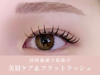 ノンチェ(Nonche)/