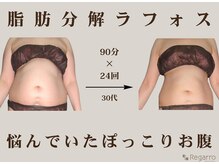 レガロビューティクリエイションズ桜川店/脂肪分解ラフォス