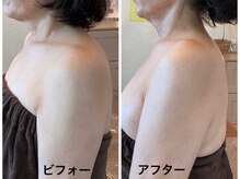 ナオフクオカ ヒーリングフォースエヌ(NaoFukuoka/healingforceN)/縮んでいた首も長く！