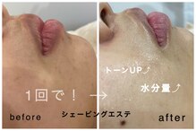 アネラ キキ サロン(anela kiki salon)