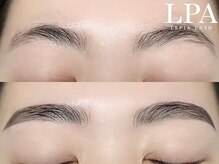 レピア 仙台店/韓国式LEPIA Before&Aｆter