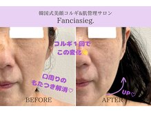 ファンシアジーク(Fanciasieg.)/韓国式美顔コルギ