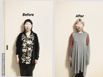 ショウフェイスデザイン(Sho Face Design)/《全身整体》ビフォーアフター