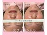 【アンパンマンは卒業　顔断捨離】デコルテ～小顔リンパケア＋光フェイシャル