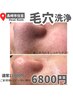 【8月限定】何をやってもダメだった頑固な毛穴汚れを除去！¥12.000→¥6.800