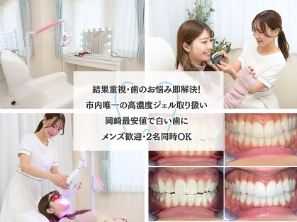 エクシアホワイトニング 岡崎店の写真
