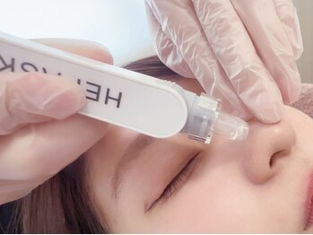 ポノ(PONO)の写真/CICA配合生炭酸タブレットで毛穴詰まり/黒ずみ/ざらつきを徹底ケア！触りたくなる素肌を取り戻しませんか？