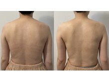 アウラ(Aula)/巡りが良くなると背中美人に