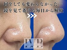 ラヴレボーテ(La Vraie Beaute)