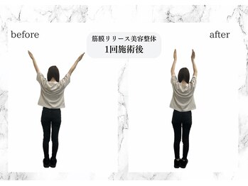トキ(TOKI)/可動域UP!!