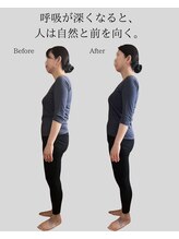 リ バース 立川(RE:birth)/猫背改善　BeforeAfter