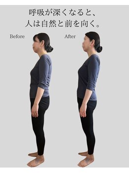 リ バース 立川(RE:birth)/猫背改善　BeforeAfter