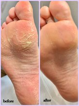 ラヴィ(La vie)/足全体乾燥