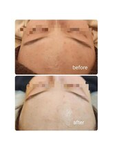 ジャドール ネイルアンドアイラッシュ(J'ADORE)/ハーブ　ビフォーアフター