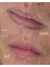 アエ(ae)/男性も♪