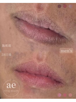 アエ(ae)/男性も♪