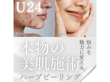 アイ アンド ネイルデイ 桂(EYE＆NAIL DAY)/毛穴ケアニキビハーブピーリング