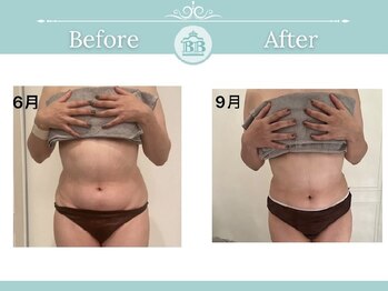 美人バスト 掛川店/痩身症例