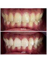 サロンニウ(salon_niu.)/５回目の症例（２０代男性）