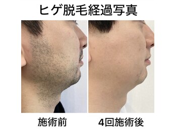 ブリランテ(Brillante)/"強めの毛"にも対応◎