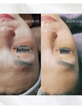 ウル(Uru)/内側か光を放つような透明感へ