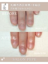 サロンペペ(salon pepe)/丸い爪・割れる爪