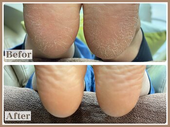 ルシェルアイの写真/角質の状態に合わせ【2種のコース】をご用意!!清潔感のある足元を叶える【ネイルケアに特化】したサロン