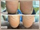 ルシェルアイの写真/角質の状態に合わせ【2種のコース】をご用意!!清潔感のある足元を叶える【ネイルケアに特化】したサロン